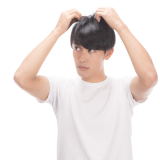 【30代・40代向け】年齢別に見る薄毛対策と育毛方法【2025年最新版】