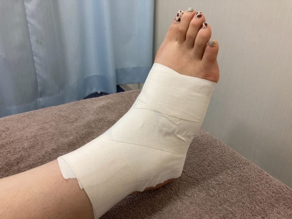 白い包帯で巻かれた足が、医療施設らしき場所で茶色のタオルの上に置かれている。爪には異なる色や模様のネイルが施されている。背景には青いカーテンが見える。