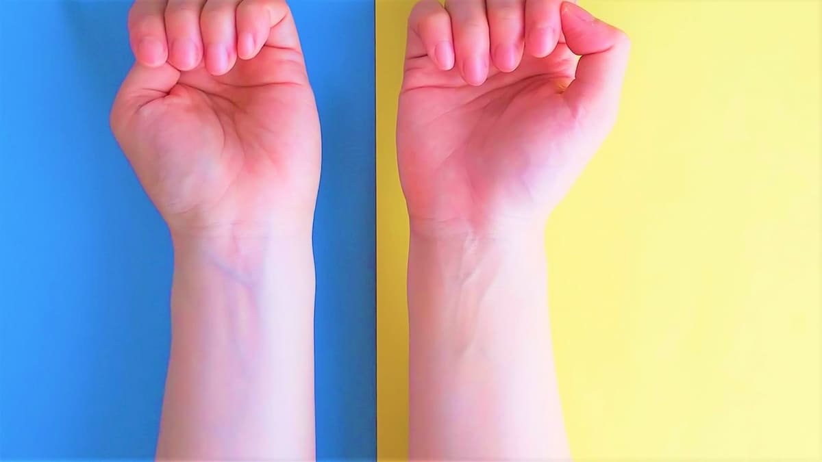 Comparing skin undertones on blue and yellow backgrounds to determine warm (Yellow Base) or cool (Blue Base) personal color.